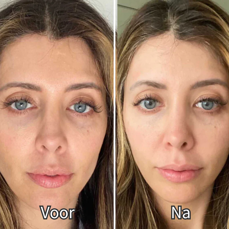 VitalGlow - Okulary do terapii światłem czerwonym